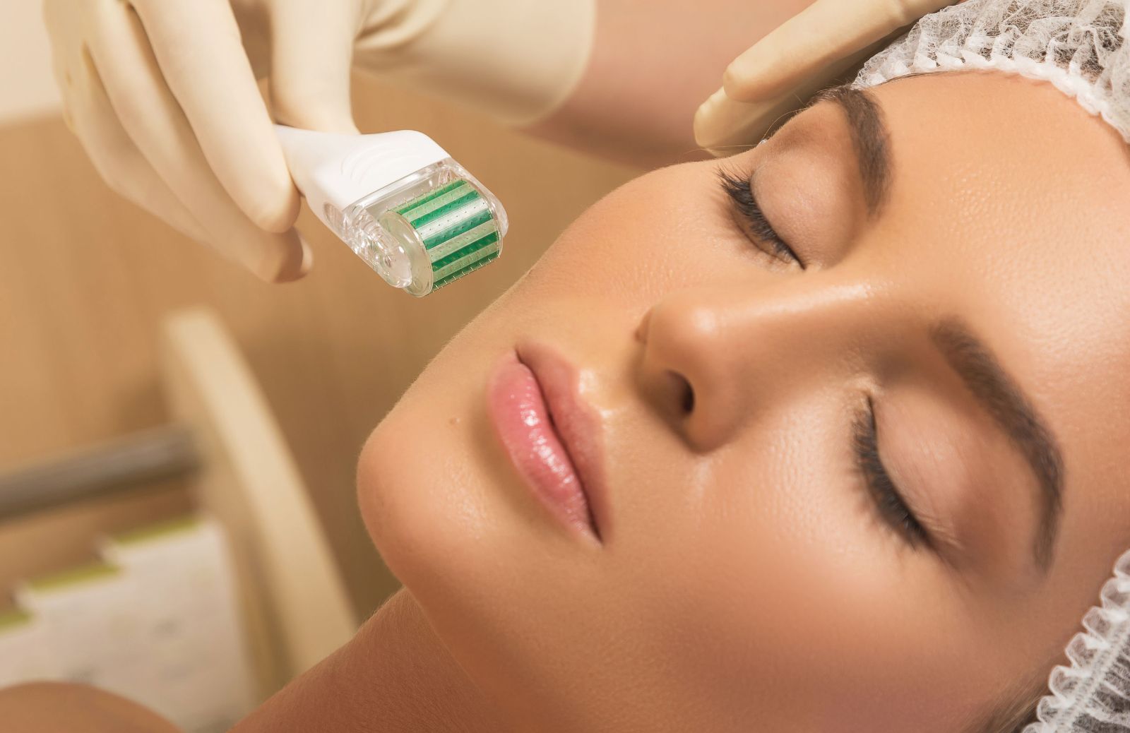 Cos'è il microneedling?