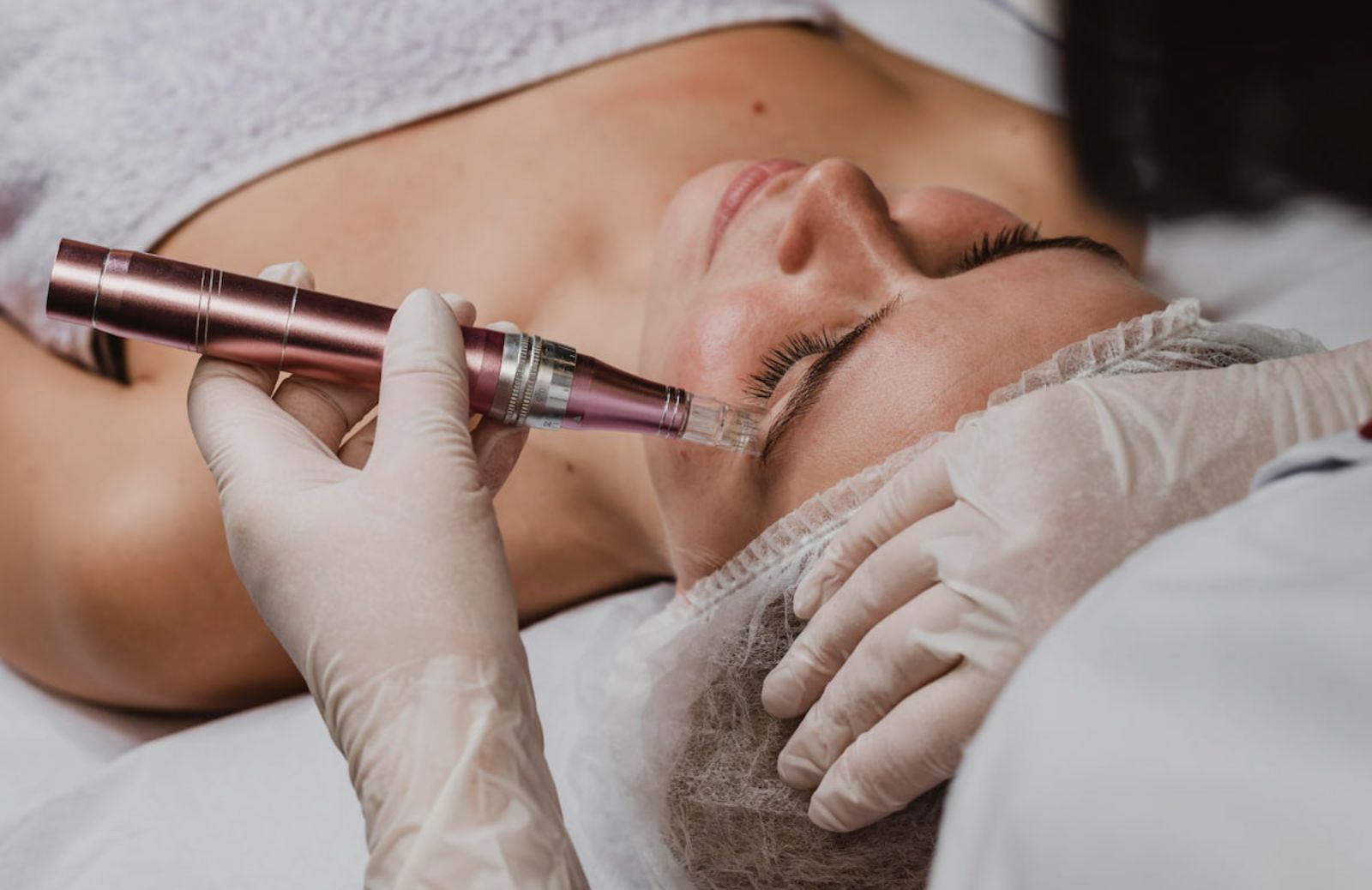 Microneedling viso: cos'è e a cosa serve