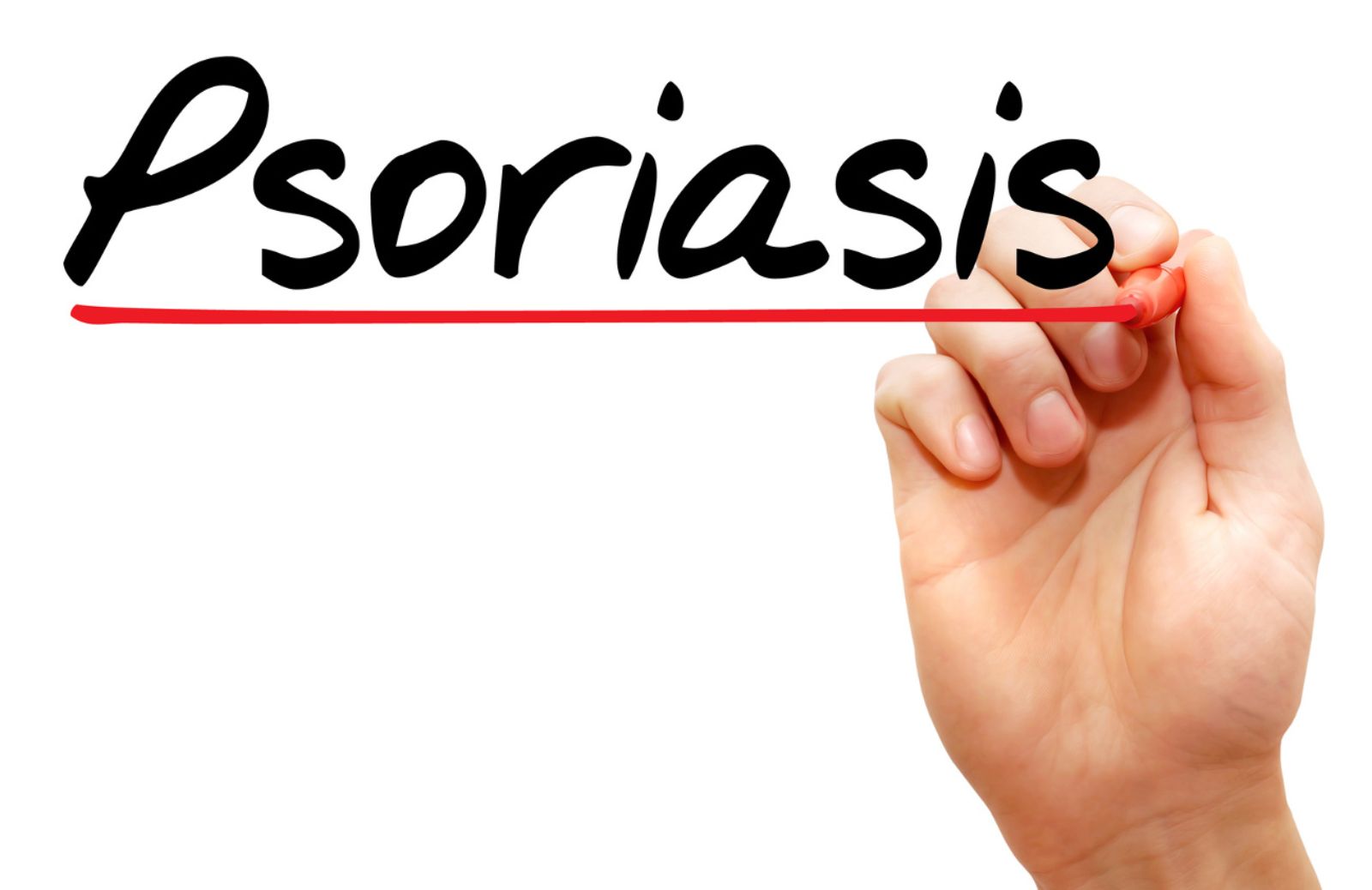 Come affrontare la psoriasi con i consigli degli esperti