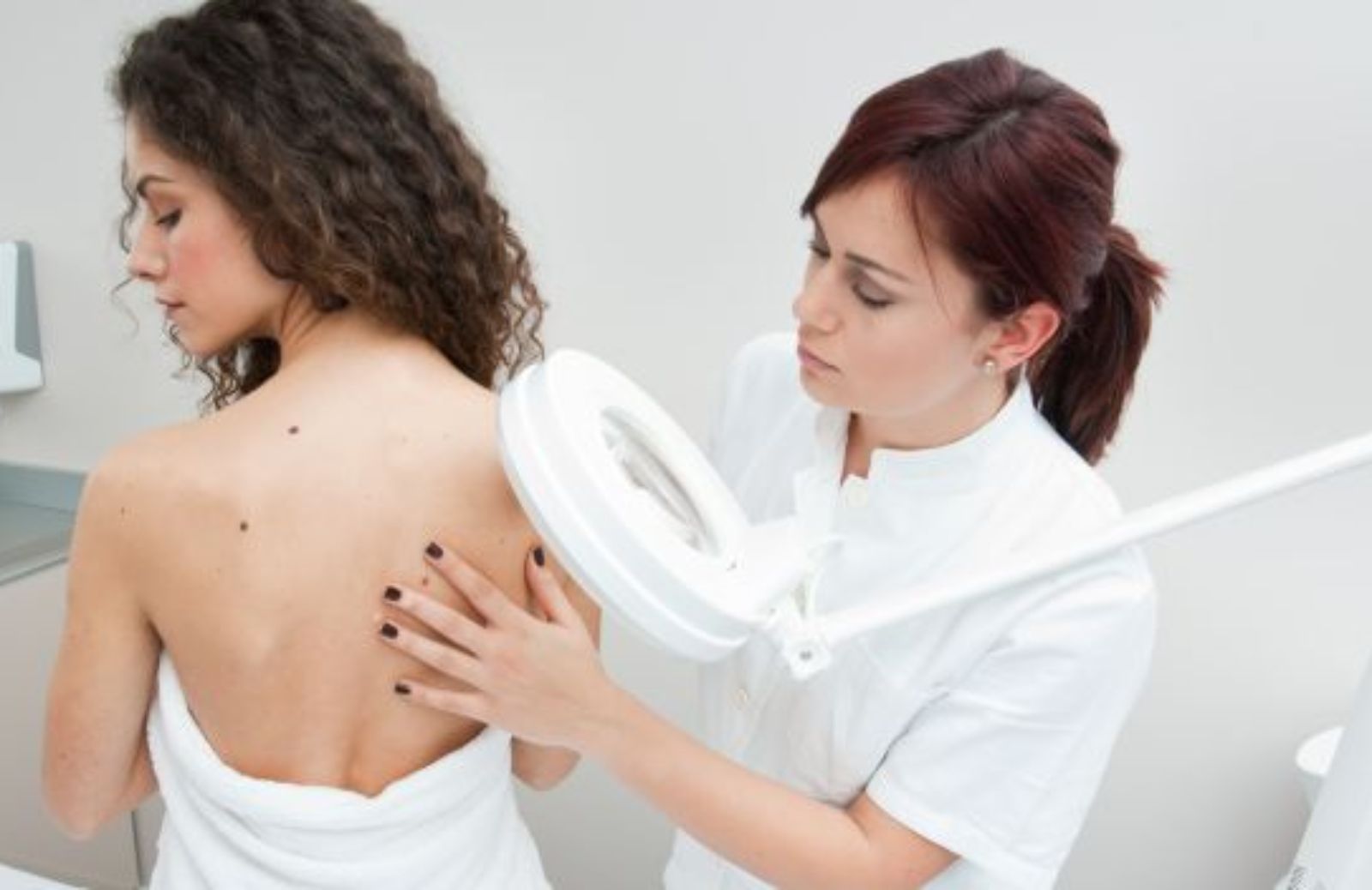 Come fare attenzione al melanoma: l'alfabeto dei nei