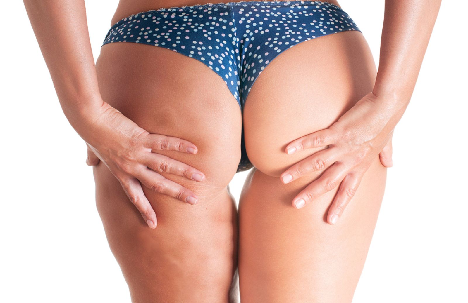 Come sconfiggere la cellulite con caffeina e centella asiatica