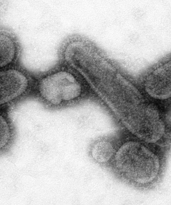 Negli ultimi mesi della Prima Guerra Mondiale, fu registrato il primo caso di influenza spagnola, in un ospedale degli Stati Uniti. Era il 1918 e fu così chiamata perché le prime notizie giunsero dalla Spagna che, a differenza di tutti gli altri Stati partecipanti al conflitto mondiale, non era sottoposta alla censura. La malattia aveva una letalità maggiore del 2,5% e fece registrare circa 50 milioni di decessi e c’è anche chi ipotizza che si raggiunsero le 100 milioni di vittime. La pandemia non risparmiò alcuna parte del mondo e il 99% dei decessi furono a carico delle persone con meno di 65 anni e quasi la metà di questi furono giovani adulti di età compresa tra i 20 e i 40.