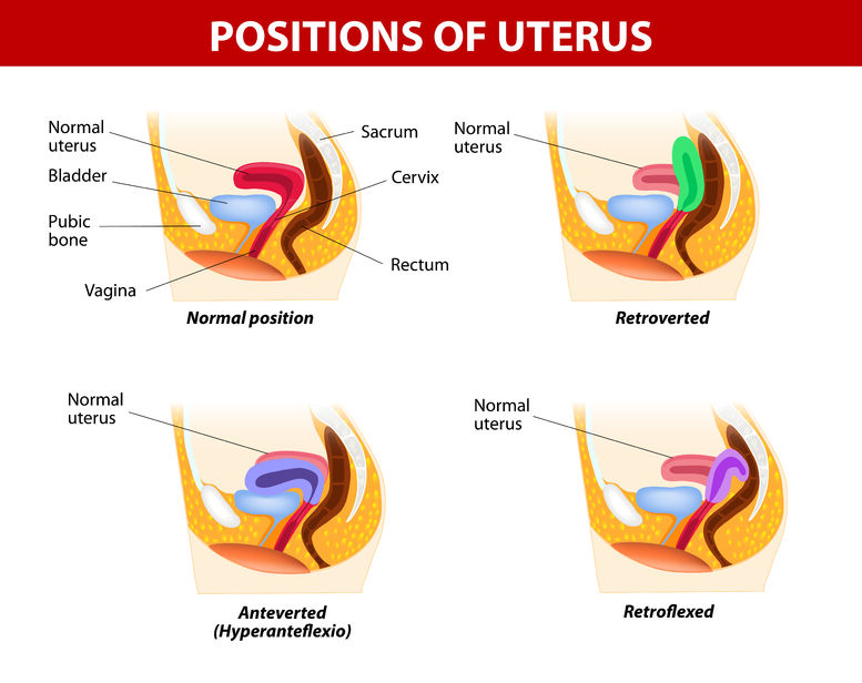 utero retroverso immagine